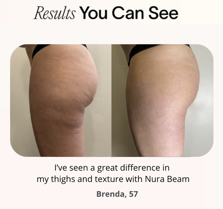 Kelvyn™ Thigh Sculpt Band